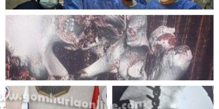 نجاح أول جراحة معقدة بمفصل الحوض في مستشفى بركة السبع بالمنوفية - الكويت الاخباري