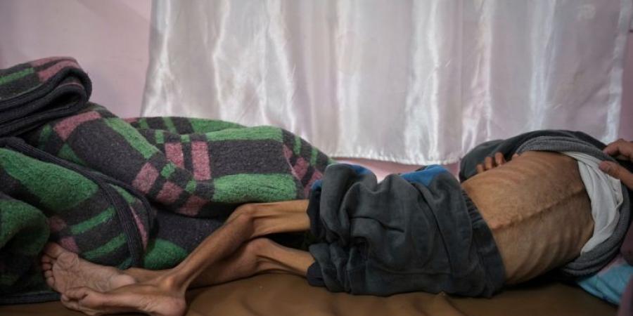 أجساد هزيلة وأعين غائرة.. أطفال غزة أول ضحايا المجاعة - الكويت الاخباري