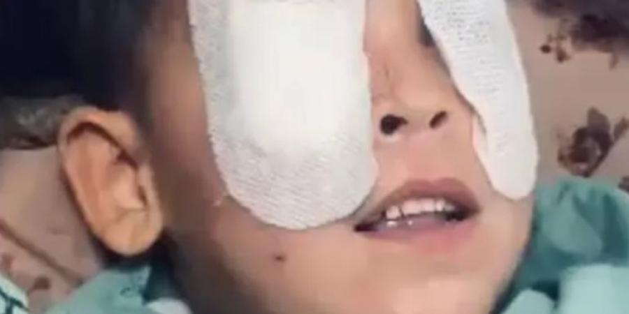 الاحتلال يطفئ عيون الغزيين وآلاف الإصابات محرومة من العلاج - الكويت الاخباري
